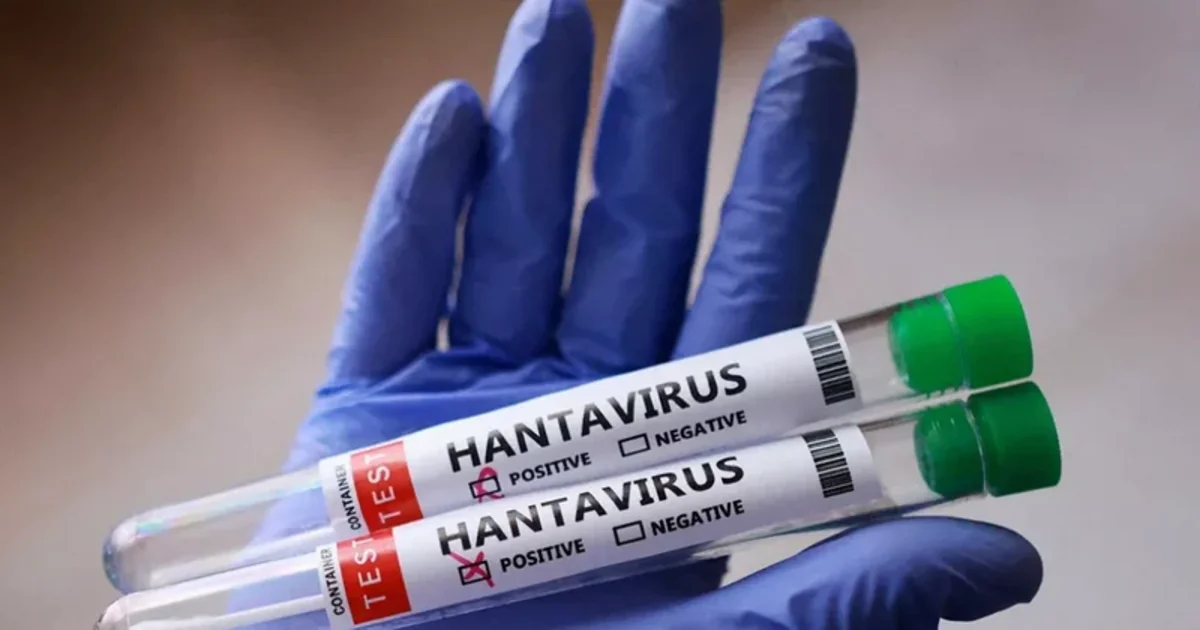 Venesuelada hantavirus diaqnozu təsdiqlənmiş üç pasiyent ölüb