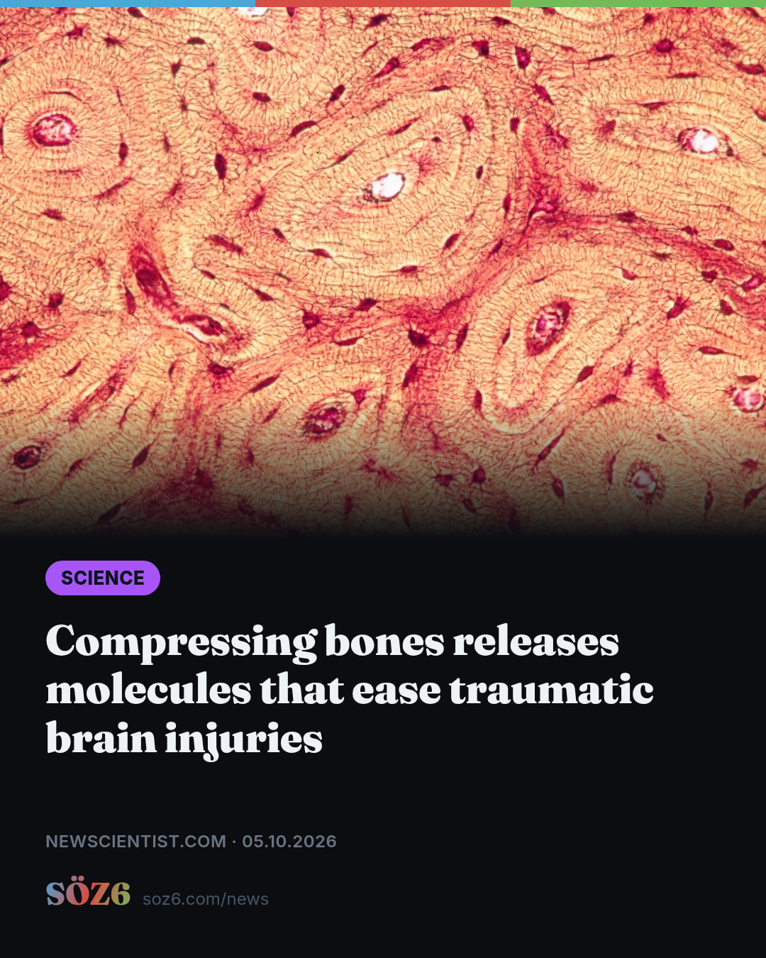 Compressing bones releases molecules that ease traumatic brain injuries