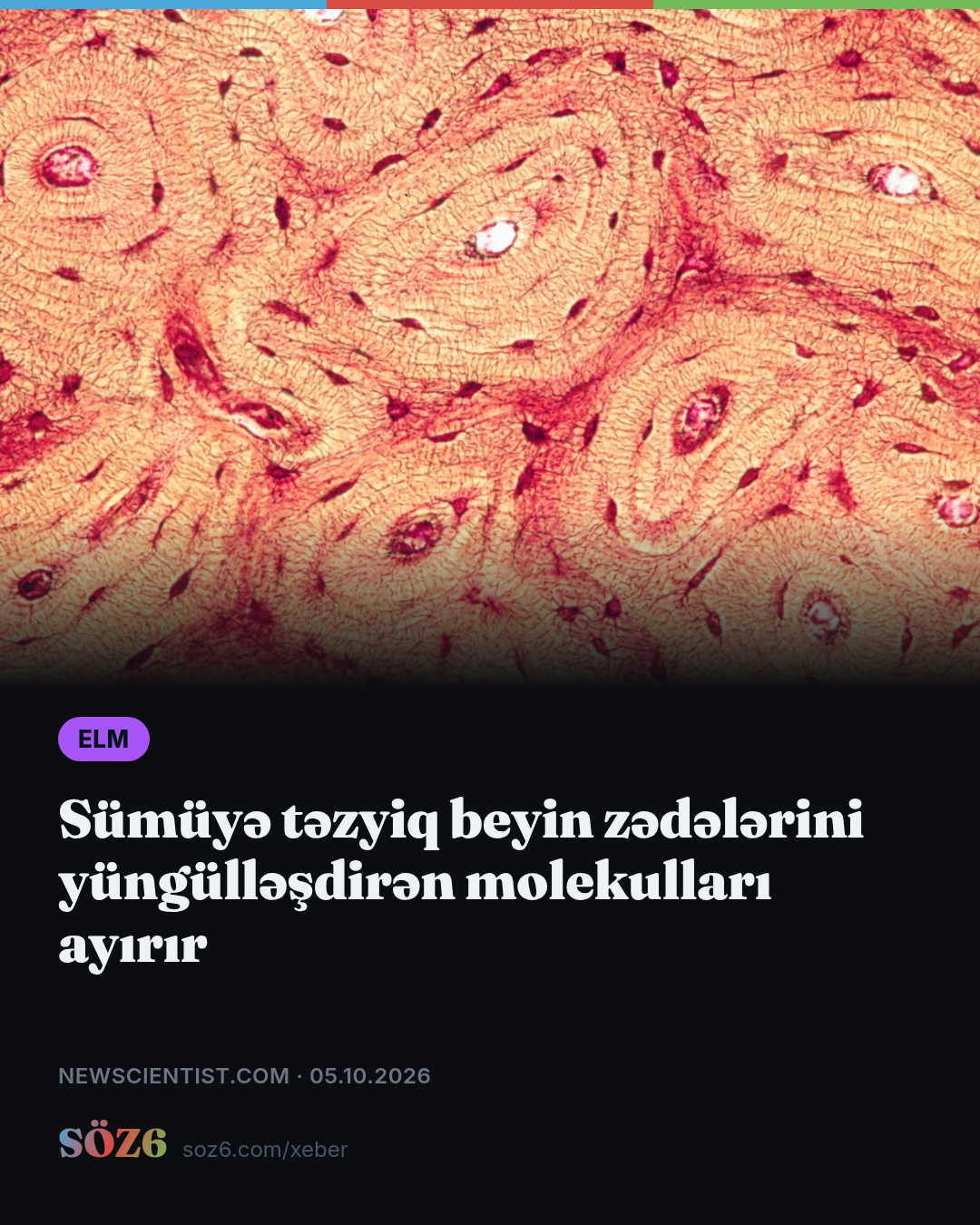 Sümüyə təzyiq beyin zədələrini yüngülləşdirən molekulları ayırır