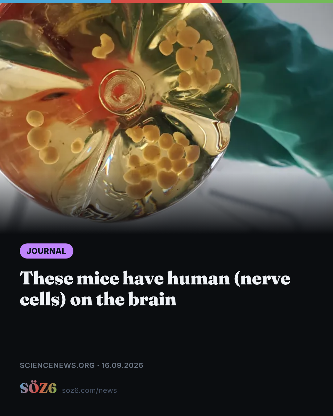 These mice have human (nerve cells) on the brain