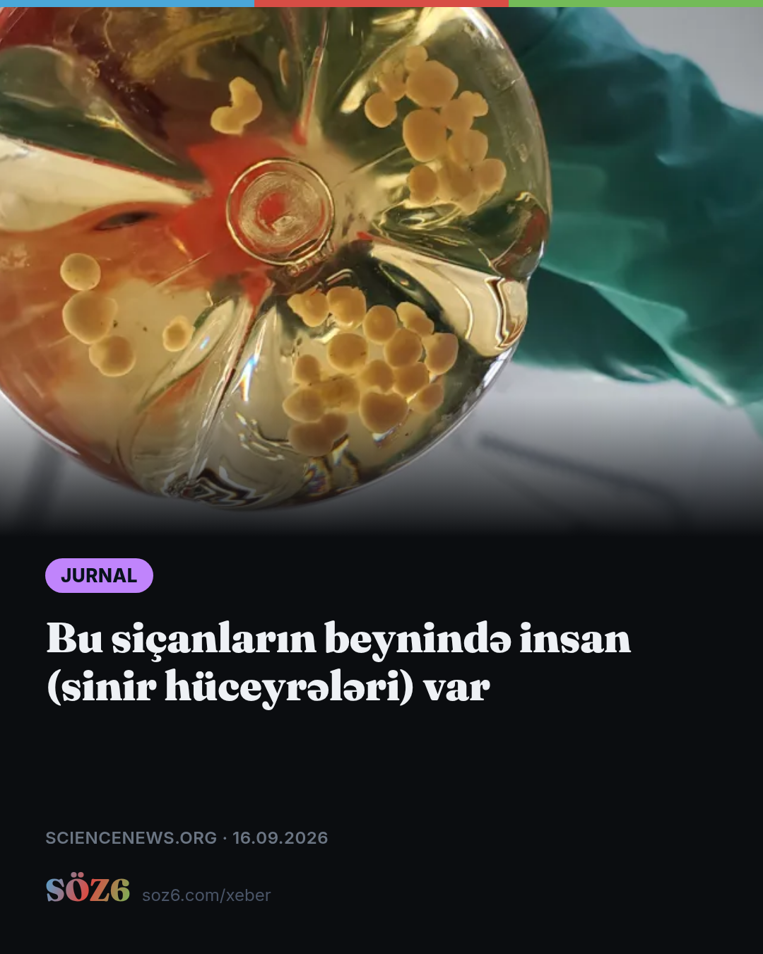 Bu siçanların beynində insan (sinir hüceyrələri) var