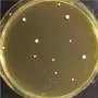 Candida auris copies its entire genome to survive antifungal treatment, research reveals