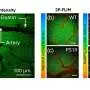 Optical imaging links altered metabolism and oxygen use in Alzheimer's disease