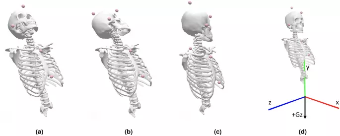 External cervical spine joint moments in pilots during high +Gz real–flight: a biomechanical analysis using individual opensim models