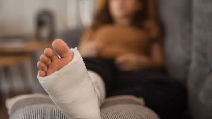 Scientists Immobilized One Leg for 14 Days and Discovered Something Unexpected