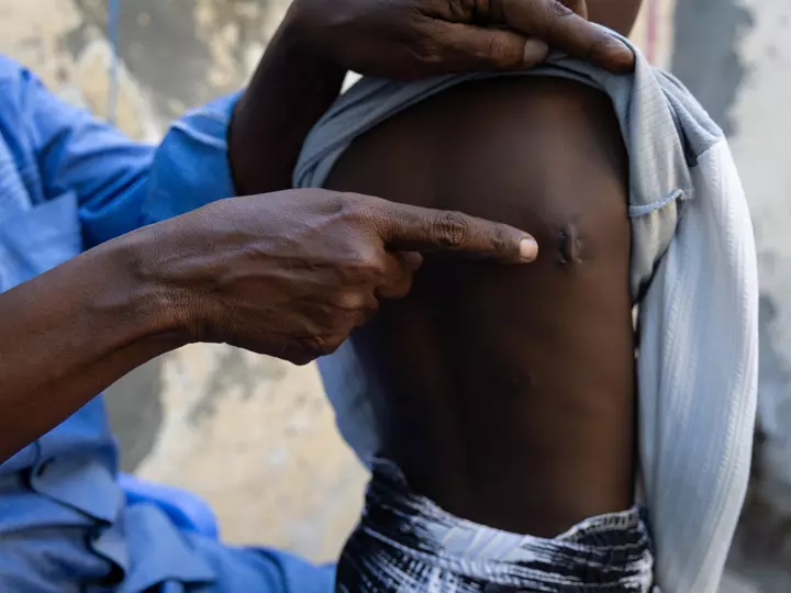 Somalidə artan ABŞ hava zərbələrinin insan itkisi