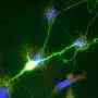 Nanoscale tech tracks proteins inside living neurons to guide Alzheimer's and Parkinson's drug discovery