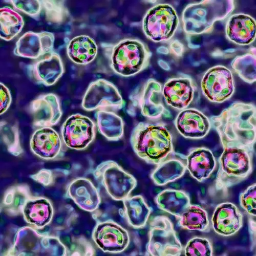Domestic travel poses growing risk for measles—and a new challenge for states