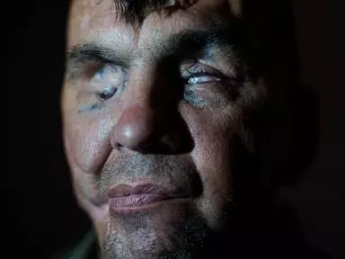 A Ukrainian soldier lost his sight in war. Now he hopes to see his children again